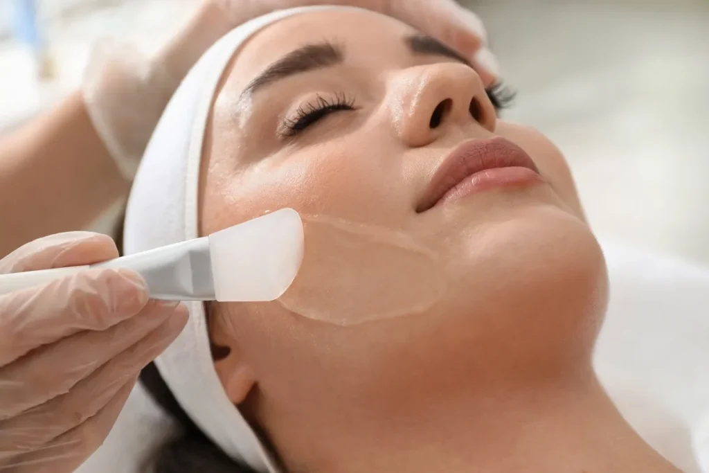 Chemical Peels In Anchorage, AK | Skin Rejuvenation