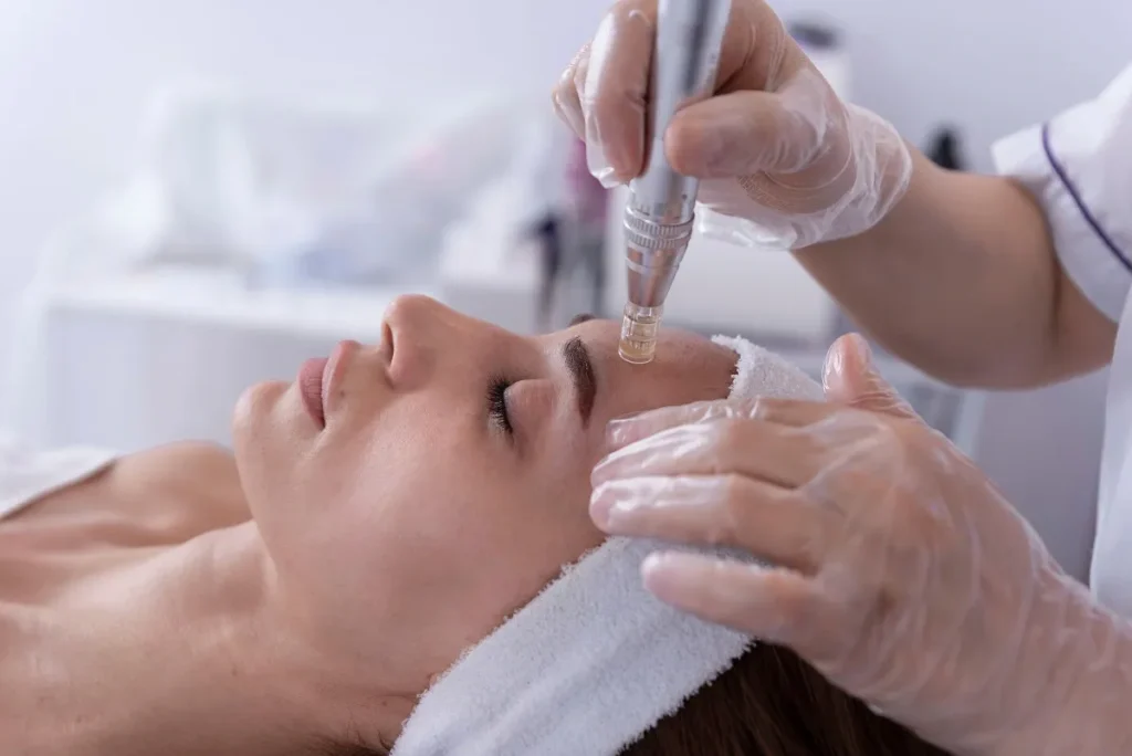 Microneedling Treatment In Anchorage, AK | Collagen Boost